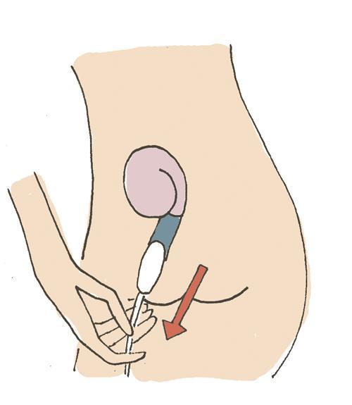 女人隐私部位要特殊保养?医生提醒:有的女性是在花钱买病