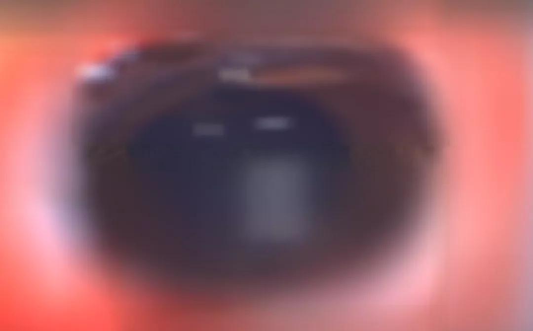 可乐瓶盖飞出去,可乐瓶盖突然冲伤眼睛