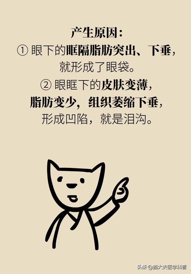 医生黑眼圈,手术消除黑眼圈靠谱吗