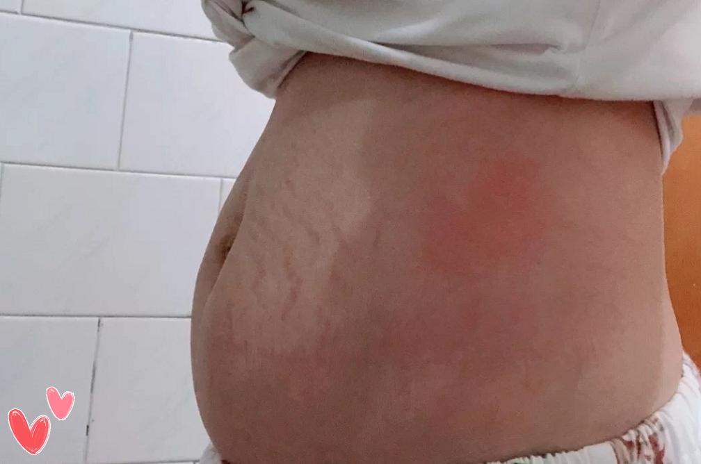 坐完月子如何调理身体,不正确的护肤让你变成黄脸婆