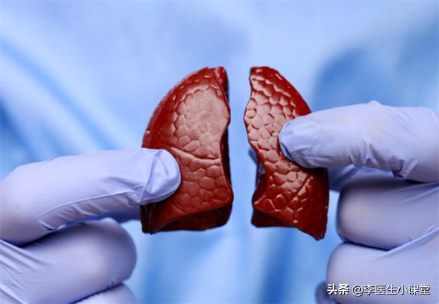 肺结节吃什么中药能让结节消失,如何让肺结节变小甚至消失