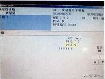 2011大众帕萨特驻车故障灯,12年帕萨特刹车灯常亮