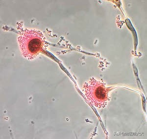 怎样辨别狗狗感染螨虫,怎么辨别狗狗感染了球虫