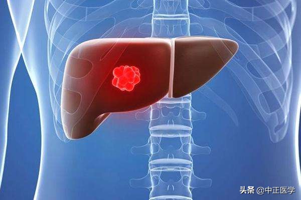 中毒到重度的肝炎能治好吗,肝炎能治好吗病毒性肝炎