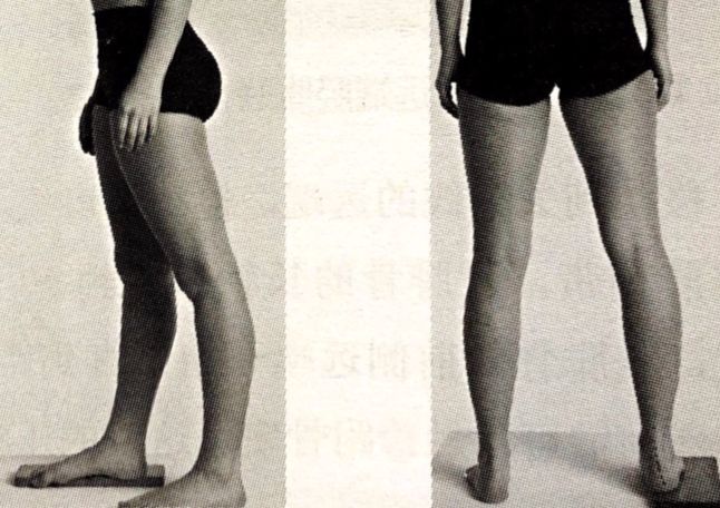 足踝损伤恢复方法,足踝损伤检查流程