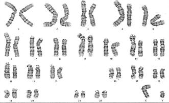 育有一孩的爸爸却被告知为“无精子症”,难道……