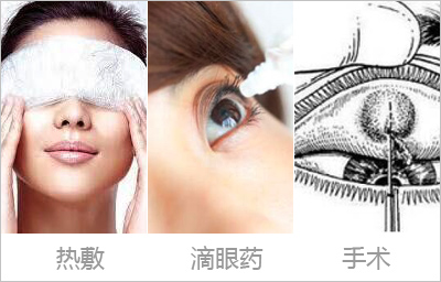 小孩子眼睛长麦粒肿怎么办,长了麦粒肿解决办法