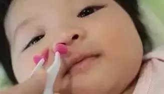 宝宝鼻子的干鼻屎要抠出来吗,鼻子里面有鼻屎抠了疼还扣不出来