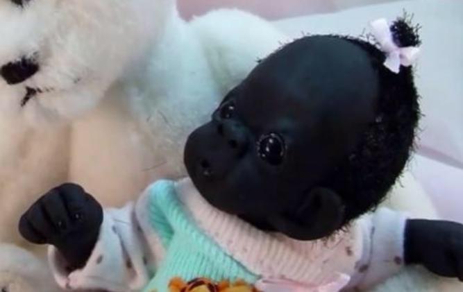 被称为世界上最黑的婴儿,世界上最黑的婴儿现在长什么样子