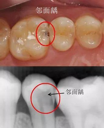 生活小窍门治牙痛视频,有没有牙痛生活小妙招的视频