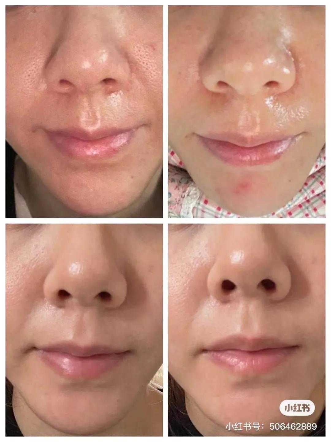 超好用的美白精华,效果比较好的美白淡斑精华便宜