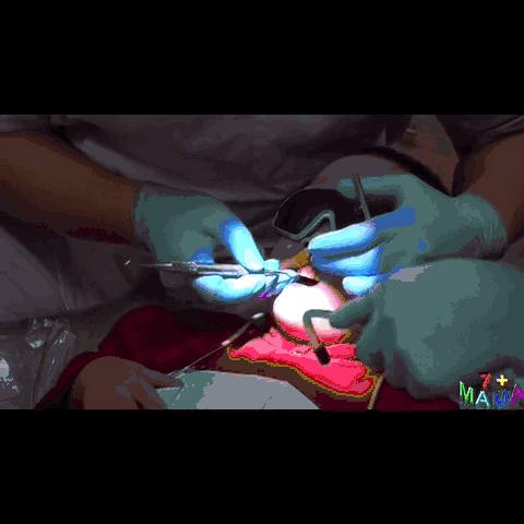 孩子牙菌斑怎么清除,孩子牙菌斑