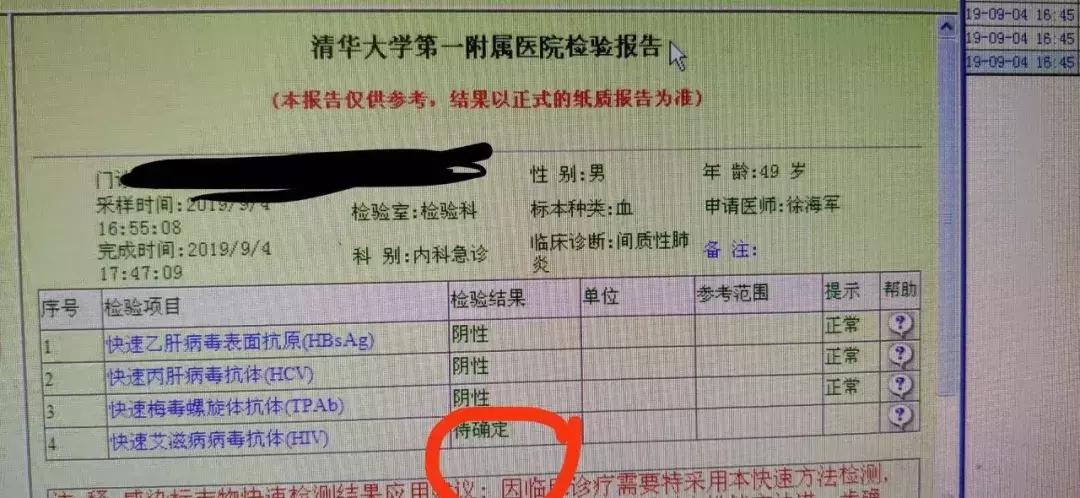 感染hiv不等于得艾滋病是真的吗,以为是肺炎结果是肺癌吓死我了