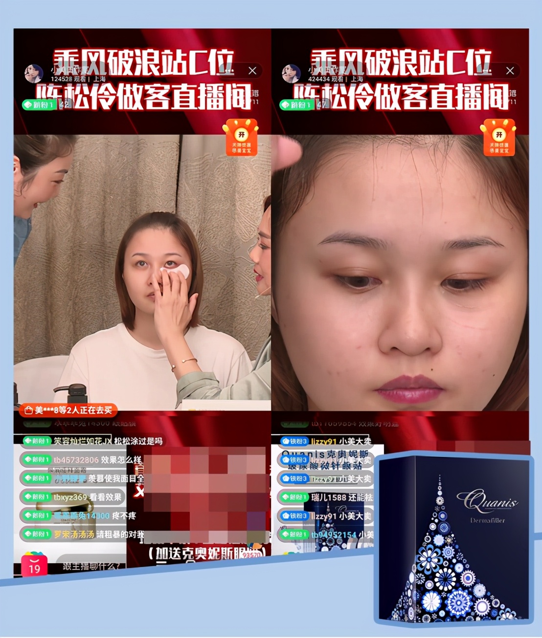 克奥妮斯微针眼膜6800,克奥妮斯微针眼膜能去法令纹吗