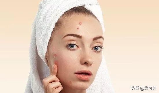 痘痘破了怎么消炎,消炎缓解痘痘