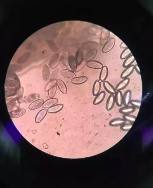 四岁女宝宝说小便地方痒和痛,四岁女宝宝说小便地方痒怎么治疗