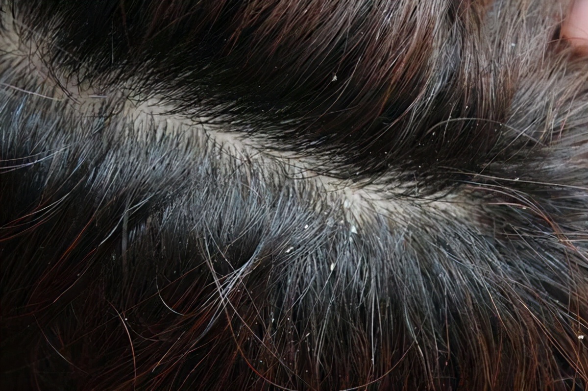 为什么男人用的毛巾枕头都会发黄,男生枕头油油的怎么洗