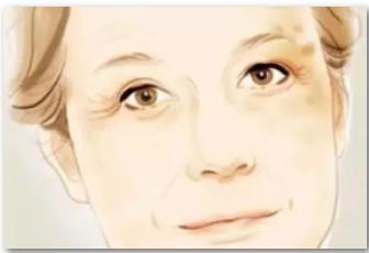 色斑有几种如何去区分,色斑在医院挂什么科