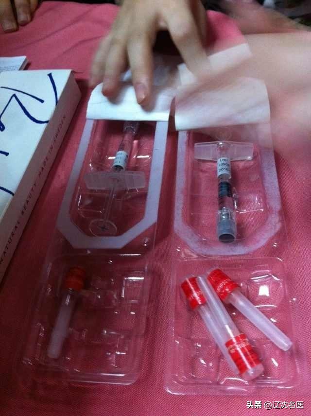 注射玻尿酸美容整形,微整形玻尿酸注射方法图解
