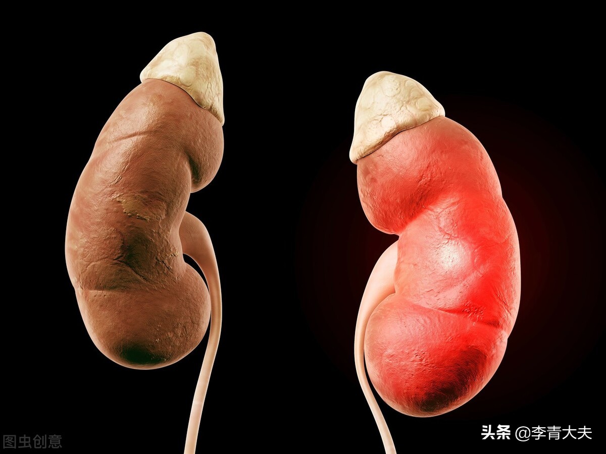 高血压合并肾病的概率,高血压低钾考虑哪种继发性高血压