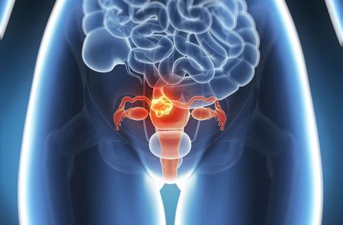 女性高发的三大癌症是哪些？早期筛查必看攻略，请接收