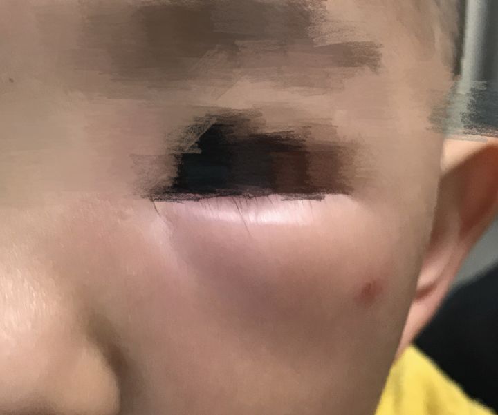 宝宝出去防蚊子叮咬的最佳方法,宝宝一直被蚊子咬怎么驱蚊