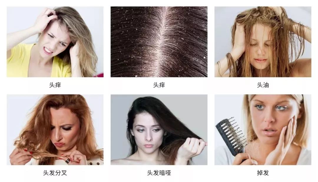 2021年平价去屑洗发水推荐测评,好的洗发水去屑顺滑蓬松控油止痒