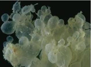 怀孕检查孕囊像葡萄怎么办,b超检查子宫没有孕囊但是怀孕了