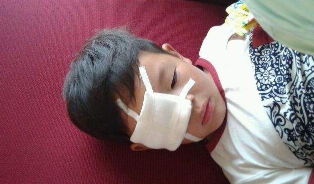 5岁女娃眼睛不慎进入石灰,孩子眼睛误入石灰粉