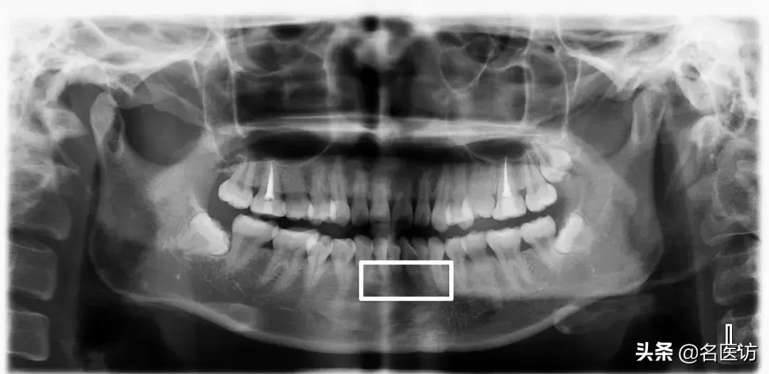 矫正牙科普馆,矫正牙齿科普知识