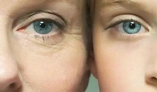 眼部肌肤衰老的真相,眼部肌肤衰老怎么保养