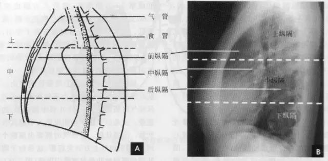 收藏：详细的胸部X线解剖，最基础最实用