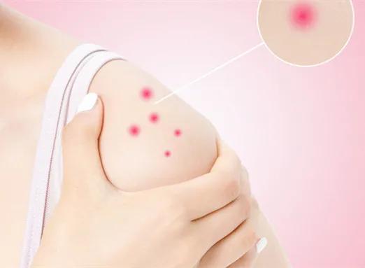 冬季皮肤瘙痒是怎么回事,冬季皮肤瘙痒是怎么回事啊