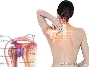 冻结肩一招解决,冻结肩怎么调