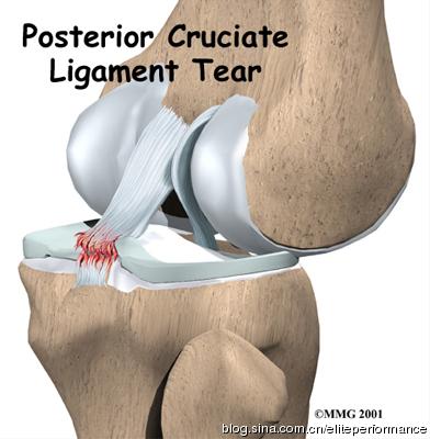 运动可以增强膝关节吗,运动会使膝关节变窄吗