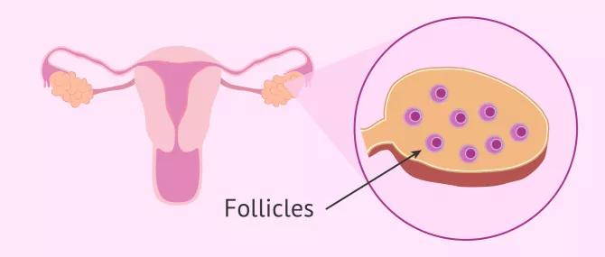 取完卵后腹水吃什么食物最好,取了34个卵一定会产生腹水吗