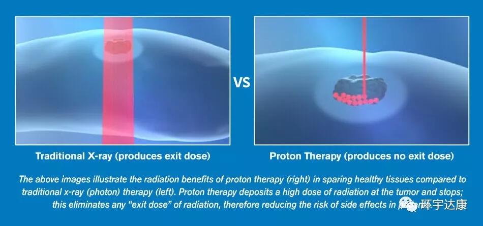 质子疗法已在中国崛起!这几类癌症患者最适合