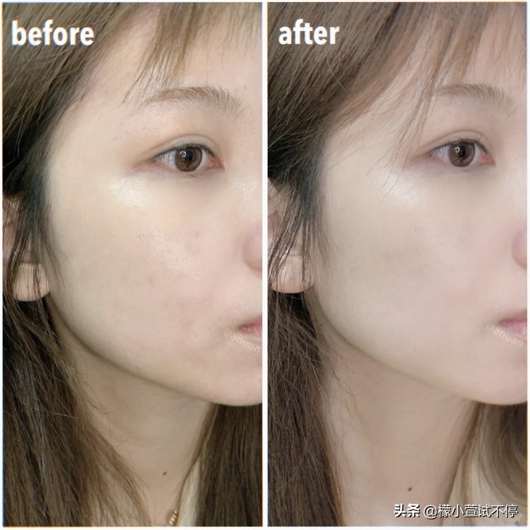 日本三大化妆水排名,日本人最爱用的保湿水