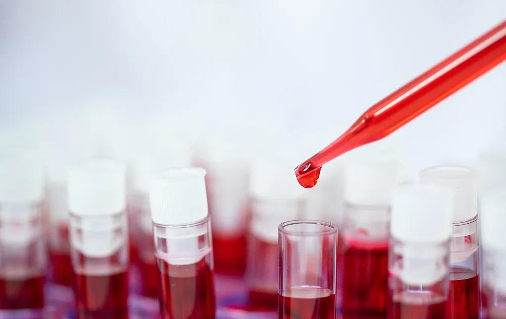 类风湿查血沉和c反应蛋白都正常,血沉和c反应蛋白正常是类风湿吗