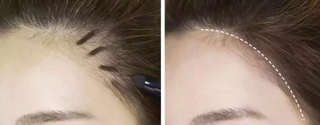 你掉的每根头发都是安全感,你掉的一根头发会怎么样