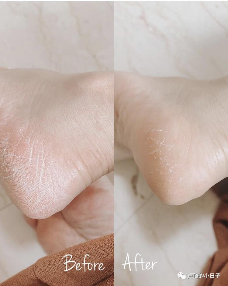 夏天必备神奇好物,一年四季的必备好物