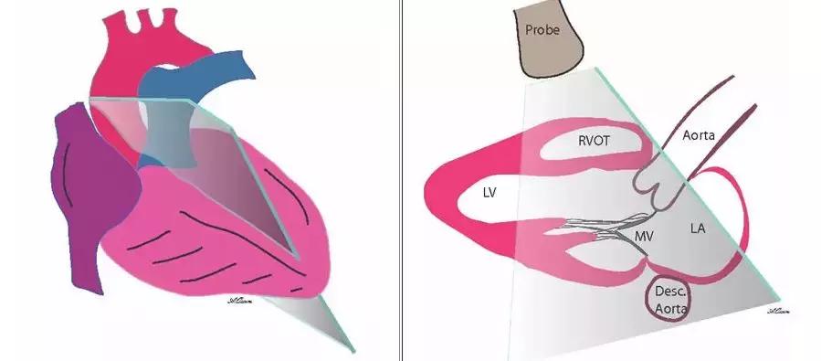 心电图和心脏彩超以哪个为准,心电图和心脏超声是一样吗