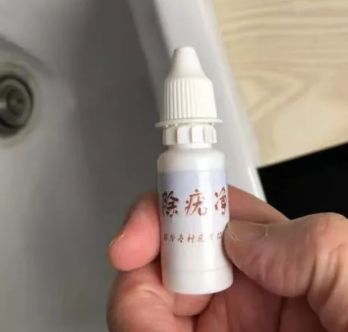 男孩眼睛被硫酸伤到,男孩被化学药水弄瞎眼睛