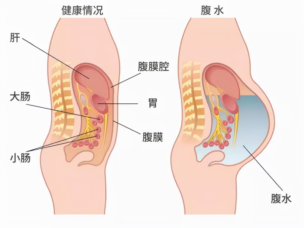 捐卵黑幕被曝光,捐卵骗局科普视频