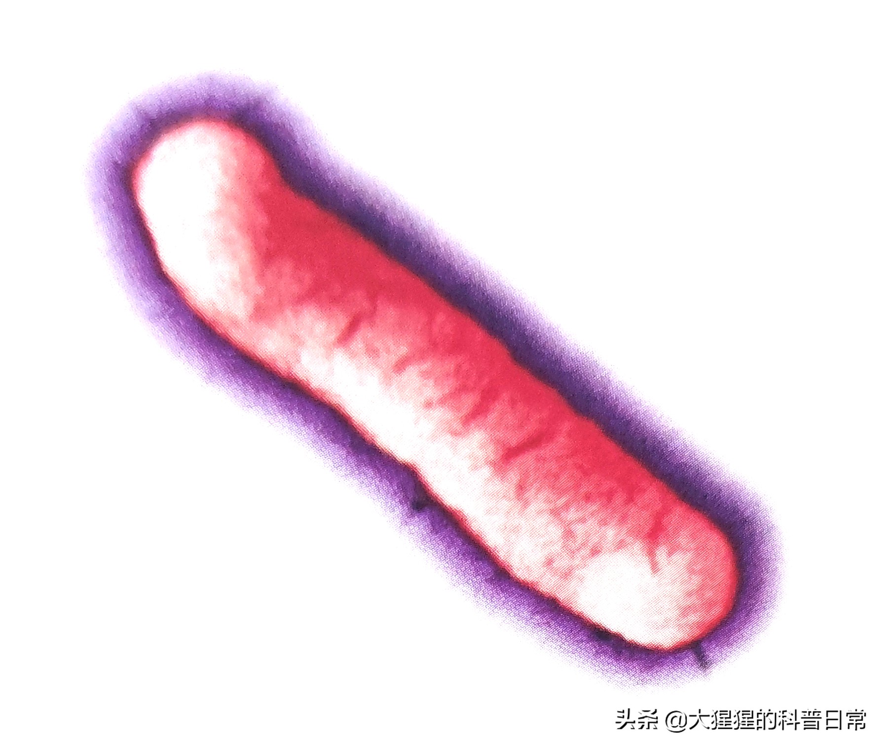 微生物原核生物,微生物照片原核生物