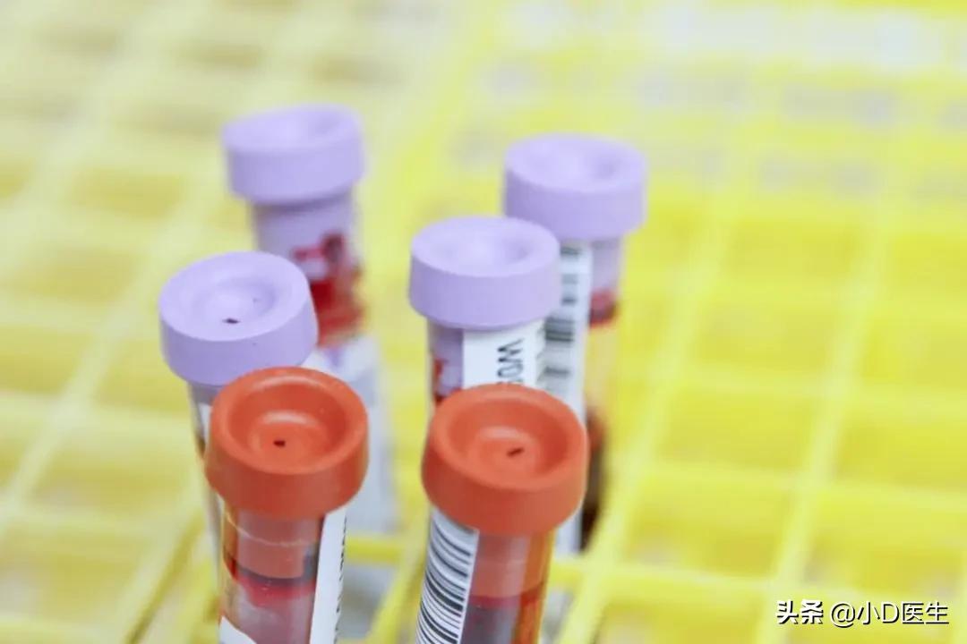 搞懂这9个问题，你也能成为血脂检查的“专家”