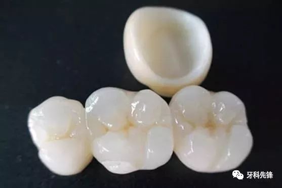 根管治疗做冠的牙齿会裂开吗,根管治疗后牙齿裂了还能做外冠吗