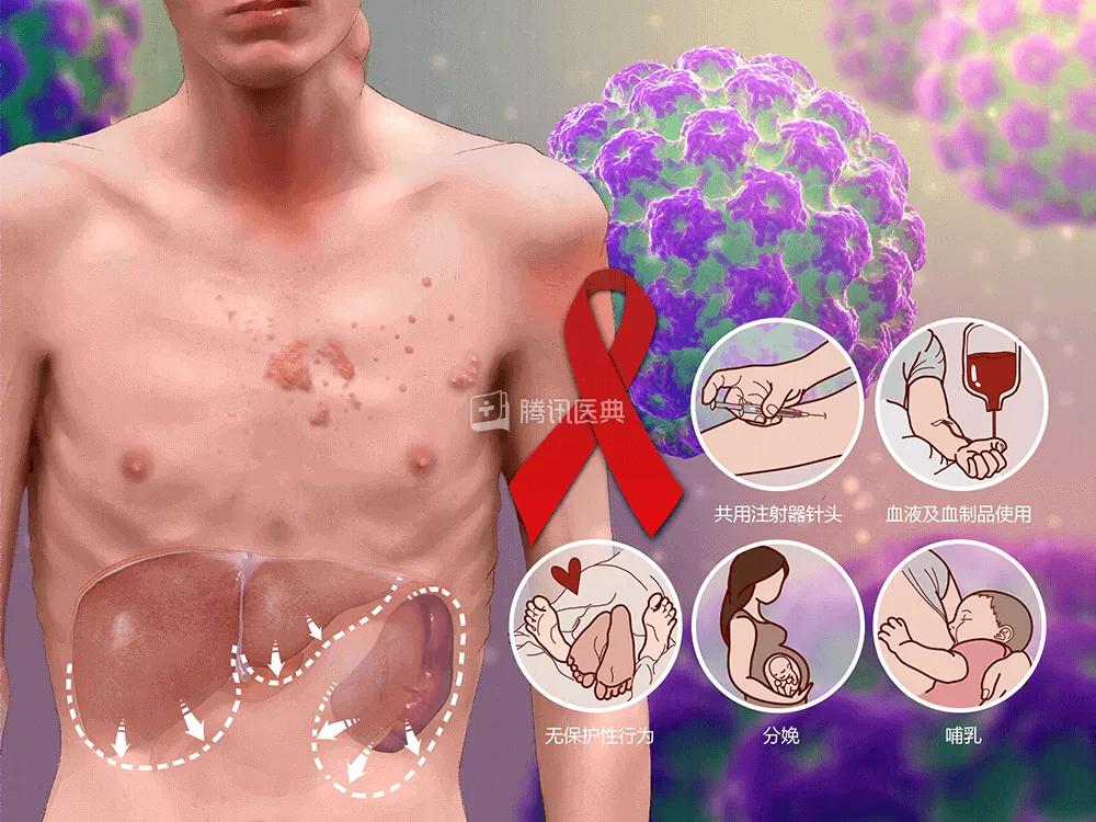 广州两网友称在路上被扎针,广州街头被扎针谣言