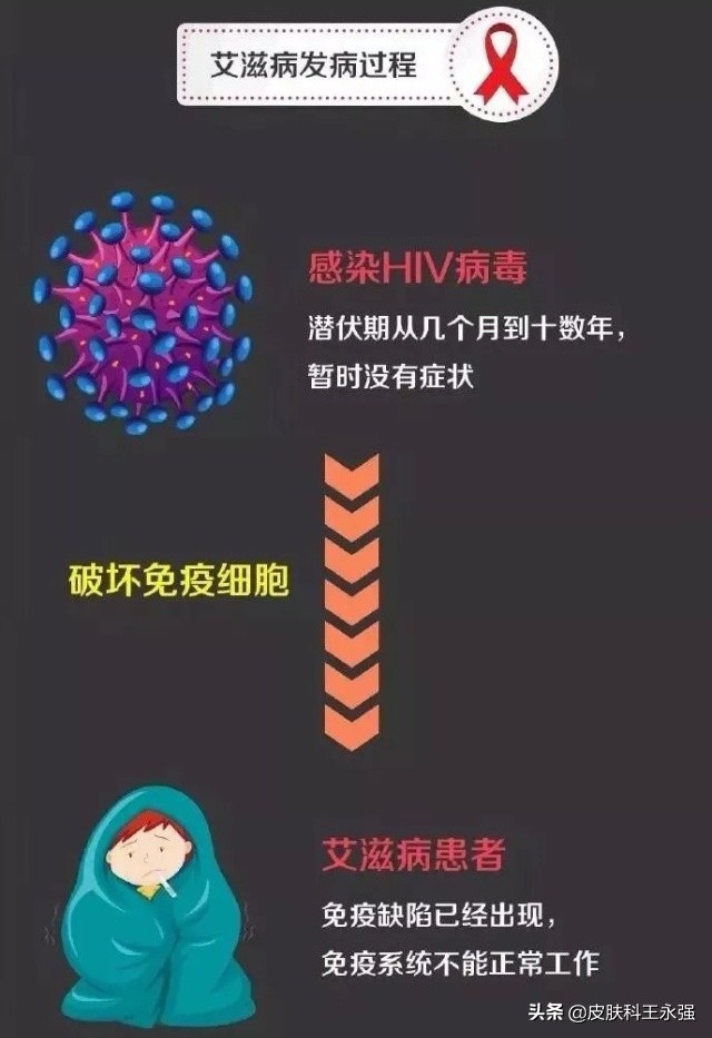 新冠会影响艾滋病疫苗的研发吗,新冠疫苗可以抵御艾滋病病毒吗