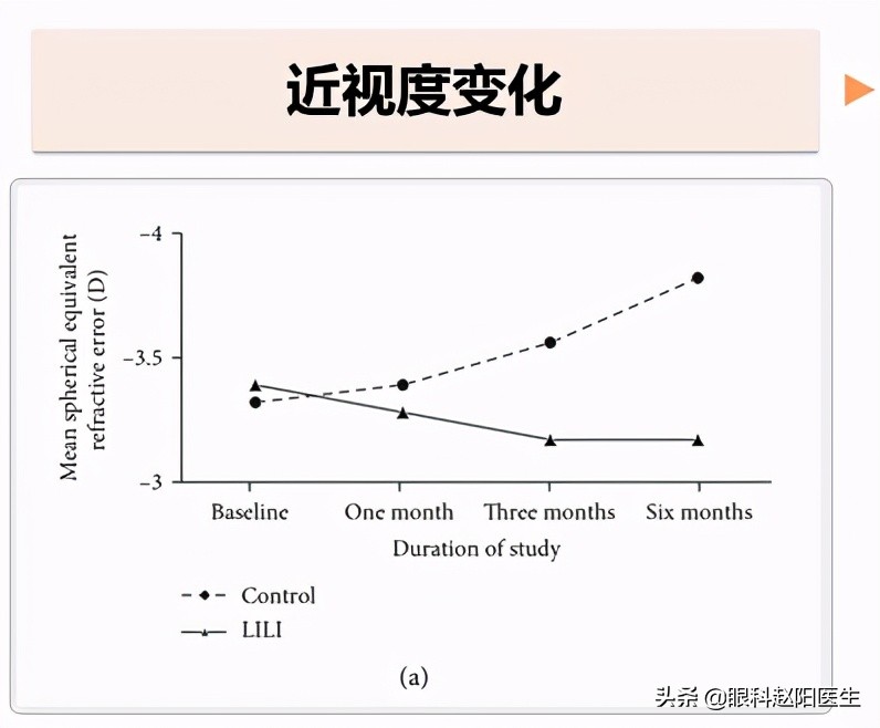 近视眼轴缩短什么原因,缩短眼间距的方法